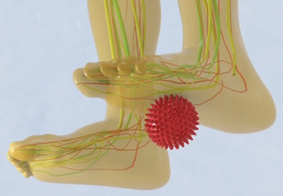 Computer-generated image of a foot pressing on a spike ball